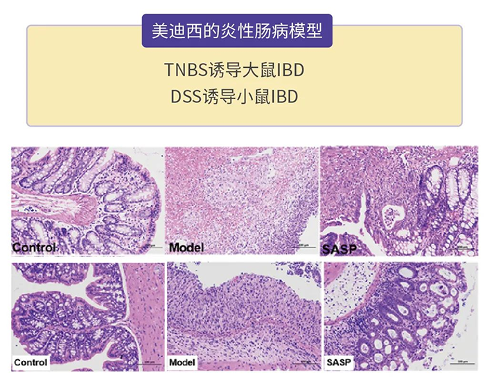 6008集团的炎性肠病模型.png